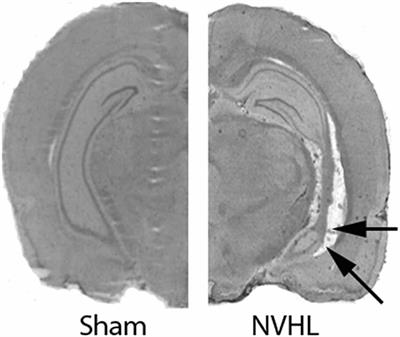 Role of Prefrontal Cortex Anti- and Pro-inflammatory Cytokines in the Development of Abnormal Behaviors Induced by Disconnection of the Ventral Hippocampus in Neonate Rats